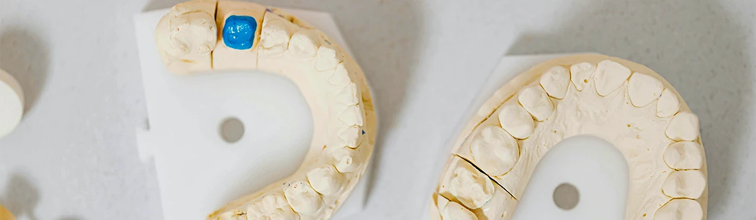 FC – Get Natural-Looking Dental Crowns at Jordan Dentistry in Cumming GA