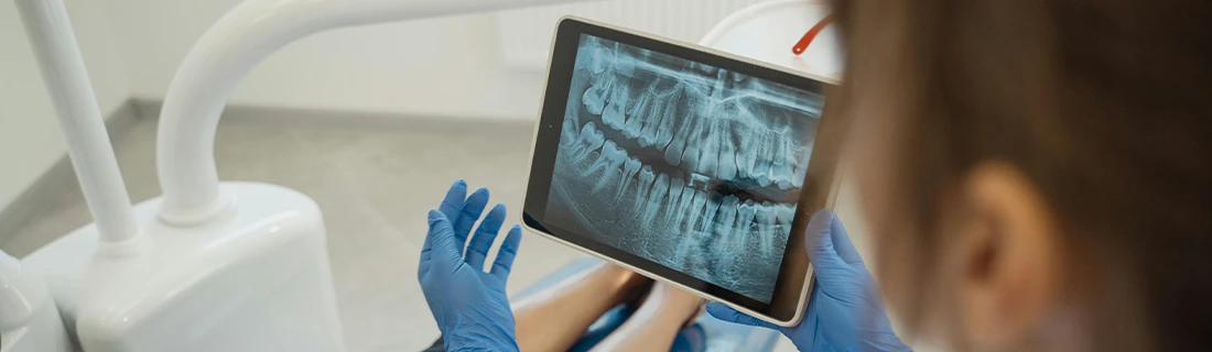 Digital X-rays in Cumming GA