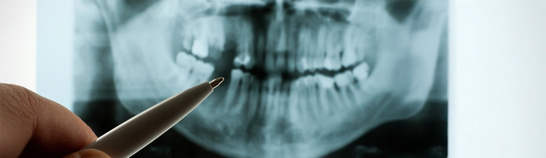 3D Dental Imaging in Cumming GA
