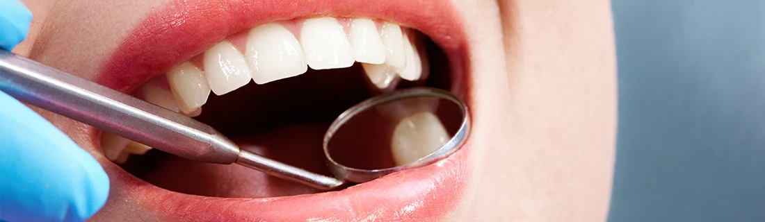 Dental Sealants in Cumming GA