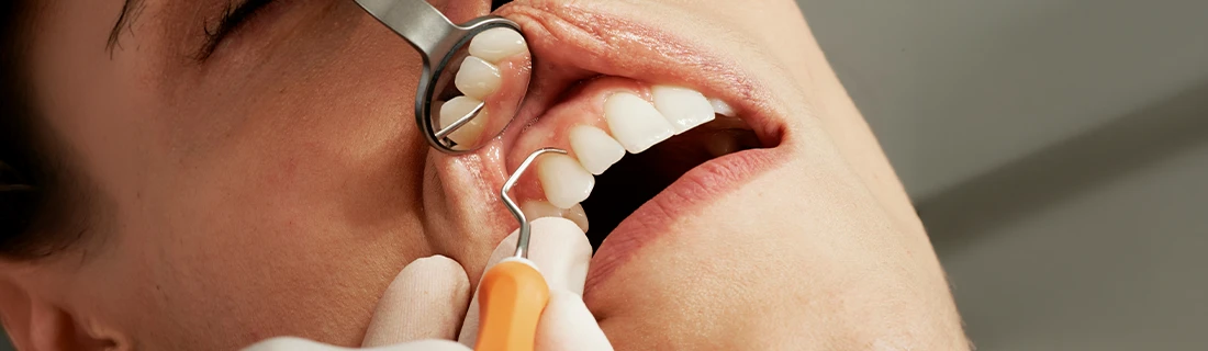 FC – Dental Care at Jordan Dentistry in Cumming GA